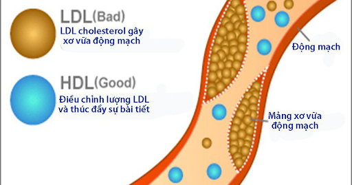 HDL-cholesterol giảm là dấu hiệu cảnh báo mỡ máu cao